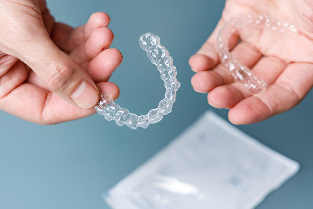 clear aligners near you