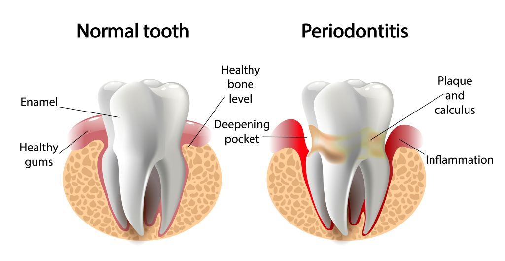 periodontal treatment near you