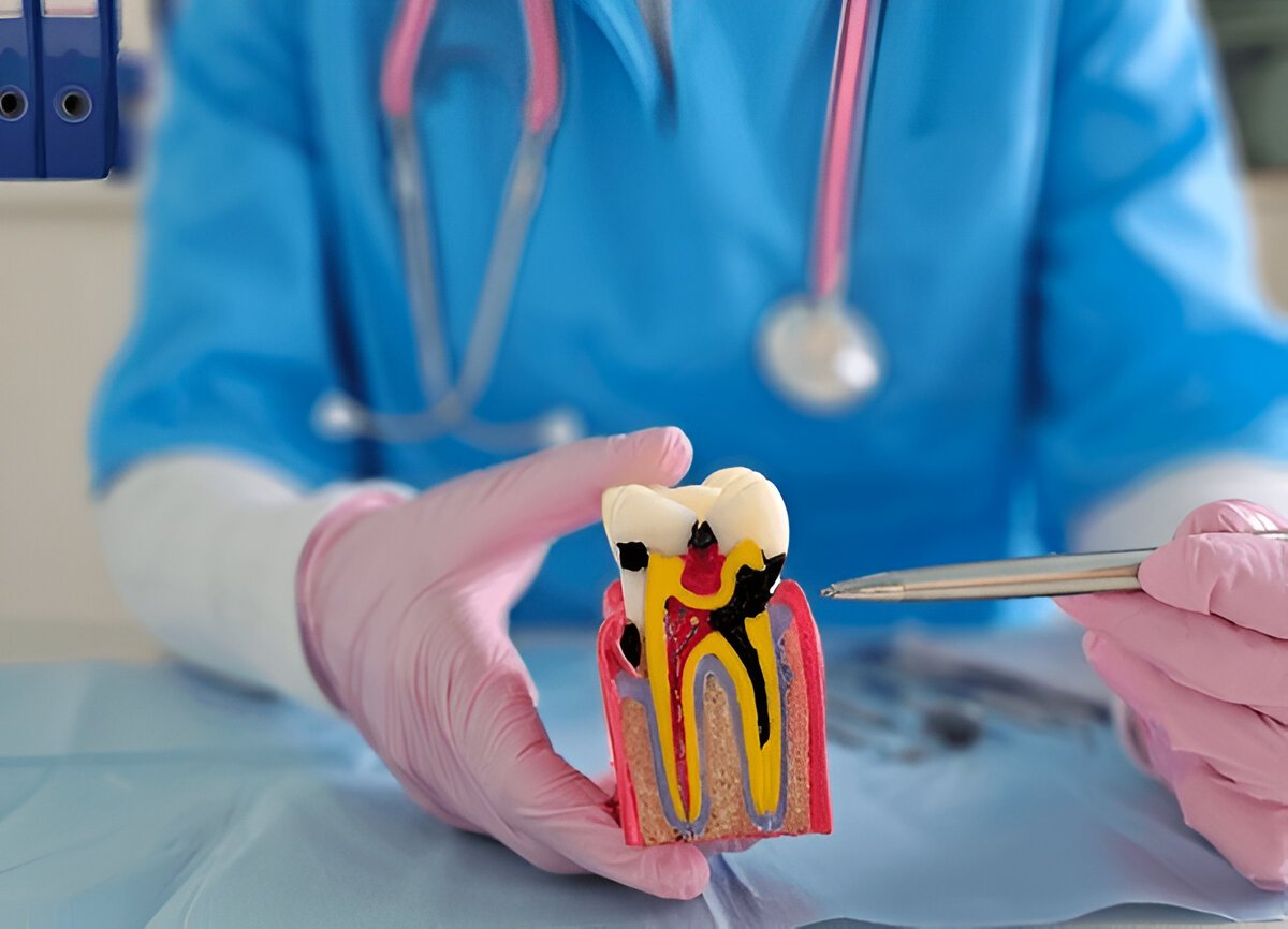Root Canal Therapy in Hamilton