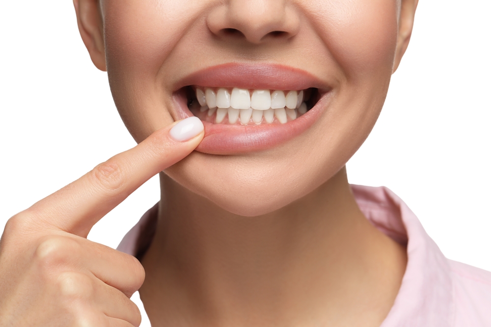 What Is Teeth Whitening and How Does It Work