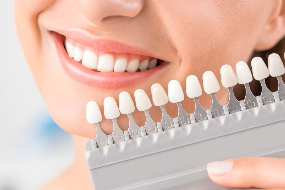 veneers for naturally dark teeth